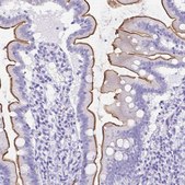 Anti-SLC13A2 antibody produced in rabbit Prestige Antibodies® Powered by Atlas Antibodies, affinity isolated antibody, buffered aqueous glycerol solution