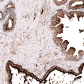 抗LGALS3BP抗体 ウサギ宿主抗体 Prestige Antibodies® Powered by Atlas Antibodies, affinity isolated antibody, buffered aqueous glycerol solution