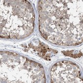 Anti-ZC3H12A antibody produced in rabbit Prestige Antibodies® Powered by Atlas Antibodies, affinity isolated antibody, buffered aqueous glycerol solution