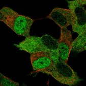 Anti-MYT1 antibody produced in rabbit Prestige Antibodies® Powered by Atlas Antibodies, affinity isolated antibody, buffered aqueous glycerol solution