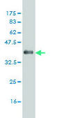 Monoclonal Anti-CSNK1G1 antibody produced in mouse clone 8A4, purified immunoglobulin, buffered aqueous solution