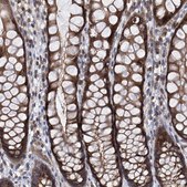 Anti-TRIM38 antibody produced in rabbit Prestige Antibodies® Powered by Atlas Antibodies, affinity isolated antibody, buffered aqueous glycerol solution