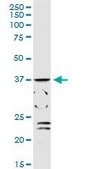 Anti-ADH1C antibody produced in rabbit purified immunoglobulin, buffered aqueous solution