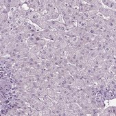 Anti-SLC22A18AS antibody produced in rabbit Prestige Antibodies® Powered by Atlas Antibodies, affinity isolated antibody, buffered aqueous glycerol solution