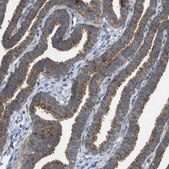 Anti-FIS1 antibody produced in rabbit Prestige Antibodies® Powered by Atlas Antibodies, affinity isolated antibody, buffered aqueous glycerol solution