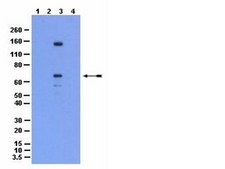 Anti-HDAC7 Antibody from rabbit, purified by affinity chromatography