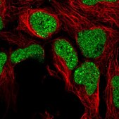 Anti-ZNF382 antibody produced in rabbit Prestige Antibodies® Powered by Atlas Antibodies, affinity isolated antibody, buffered aqueous glycerol solution