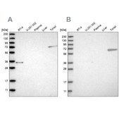 Anti-FNBP1 antibody produced in rabbit Prestige Antibodies® Powered by Atlas Antibodies, affinity isolated antibody, buffered aqueous glycerol solution