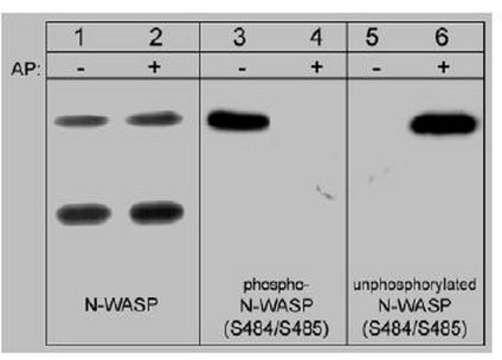 Anti-N-WASP Antibody, phospho-specific [Ser484/Ser485] Chemicon&#174;, from rabbit