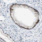 Anti-CYP4X1 antibody produced in rabbit Prestige Antibodies® Powered by Atlas Antibodies, affinity isolated antibody, buffered aqueous glycerol solution