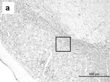 Anti-Tyrosine Hydroxylase Antibody Chemicon®, from rabbit