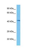 Anti-PHKG2 antibody produced in rabbit affinity isolated antibody