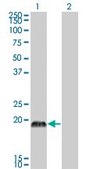 Monoclonal Anti-CSRP3 antibody produced in mouse clone 6D2, purified immunoglobulin, buffered aqueous solution