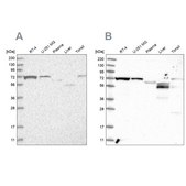 Anti-SLC25A12 antibody produced in rabbit Prestige Antibodies® Powered by Atlas Antibodies, affinity isolated antibody, buffered aqueous glycerol solution