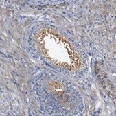 Anti-CYB561 antibody produced in rabbit Prestige Antibodies® Powered by Atlas Antibodies, affinity isolated antibody, buffered aqueous glycerol solution