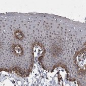 Anti-ZNF750 antibody produced in rabbit Prestige Antibodies® Powered by Atlas Antibodies, affinity isolated antibody, buffered aqueous glycerol solution, Ab1