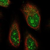 Anti-ABHD14B antibody produced in rabbit Prestige Antibodies® Powered by Atlas Antibodies, affinity isolated antibody, buffered aqueous glycerol solution