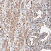 Anti-MPRIP antibody produced in rabbit Prestige Antibodies® Powered by Atlas Antibodies, affinity isolated antibody, buffered aqueous glycerol solution, Ab2