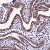 Anti-TCOF1 antibody produced in rabbit Prestige Antibodies® Powered by Atlas Antibodies, affinity isolated antibody, buffered aqueous glycerol solution