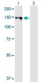 Anti-DSG1 antibody produced in rabbit purified immunoglobulin, buffered aqueous solution