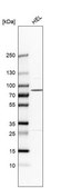 Anti-PLA2G6 antibody produced in rabbit Prestige Antibodies® Powered by Atlas Antibodies, affinity isolated antibody, buffered aqueous glycerol solution