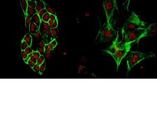Anti-EHMT1 Antibody from rabbit