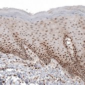 Monoclonal Anti-CDK4 antibody produced in mouse Prestige Antibodies® Powered by Atlas Antibodies, clone CL8102, purified immunoglobulin, buffered aqueous glycerol solution