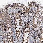 Anti-POC1A antibody produced in rabbit Prestige Antibodies® Powered by Atlas Antibodies, affinity isolated antibody, buffered aqueous glycerol solution