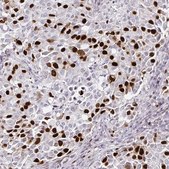 Monoclonal Anti-ANLN antibody produced in mouse Prestige Antibodies® Powered by Atlas Antibodies, clone CL0301, purified immunoglobulin, buffered aqueous glycerol solution