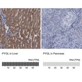 Anti-PYGL antibody produced in rabbit Prestige Antibodies® Powered by Atlas Antibodies, affinity isolated antibody, buffered aqueous glycerol solution