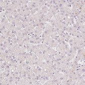 Anti-MYBL1 antibody produced in rabbit Prestige Antibodies® Powered by Atlas Antibodies, affinity isolated antibody, buffered aqueous glycerol solution