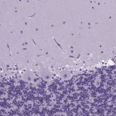 Anti-FOXI1 antibody produced in rabbit Prestige Antibodies® Powered by Atlas Antibodies, affinity isolated antibody, buffered aqueous glycerol solution