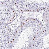 Anti-TCF3 antibody produced in rabbit Prestige Antibodies® Powered by Atlas Antibodies, affinity isolated antibody, buffered aqueous glycerol solution
