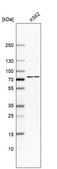 Anti-ABCF2 antibody produced in rabbit Prestige Antibodies® Powered by Atlas Antibodies, affinity isolated antibody, buffered aqueous glycerol solution, Ab2