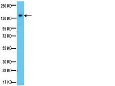 Anti-IGF-IR Antibody, β-subunit, clone 1-2 clone 1-2, from mouse, purified by affinity chromatography