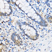Anti-PPAR gamma antibody produced in rabbit