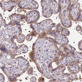 Anti-SH3TC2 antibody produced in rabbit Prestige Antibodies® Powered by Atlas Antibodies, affinity isolated antibody, buffered aqueous glycerol solution