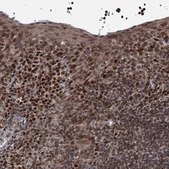 Anti-PHC3 antibody produced in rabbit Prestige Antibodies® Powered by Atlas Antibodies, affinity isolated antibody, buffered aqueous glycerol solution