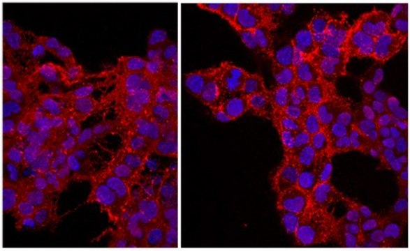 Anti-NG2 Chondroitin Sulfate Proteoglycan, Cy3 Conjugate Antibody from rabbit, CY3 conjugate