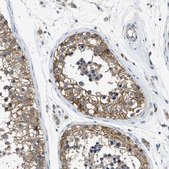 Anti-PANX1 antibody produced in rabbit Prestige Antibodies® Powered by Atlas Antibodies, affinity isolated antibody, buffered aqueous glycerol solution