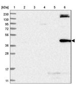 Anti-TRMT2B antibody produced in rabbit Prestige Antibodies® Powered by Atlas Antibodies, affinity isolated antibody, buffered aqueous glycerol solution