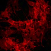 OP9-DL1 hDL-1-Expressing mOP9 Cell Line