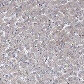 Anti-ABCF2 antibody produced in rabbit Prestige Antibodies® Powered by Atlas Antibodies, affinity isolated antibody, buffered aqueous glycerol solution, Ab1