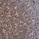Anti-PIWIL4 antibody produced in rabbit Prestige Antibodies® Powered by Atlas Antibodies, affinity isolated antibody, buffered aqueous glycerol solution