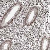 Anti-CHD4 antibody produced in rabbit Prestige Antibodies® Powered by Atlas Antibodies, affinity isolated antibody, buffered aqueous glycerol solution