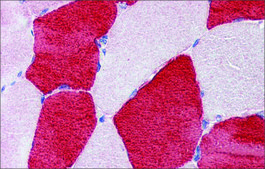 Anti-TNNI1 (AB1) antibody produced in rabbit affinity isolated antibody