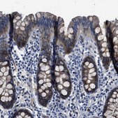 Anti-SPEG antibody produced in rabbit Prestige Antibodies® Powered by Atlas Antibodies, affinity isolated antibody, buffered aqueous glycerol solution