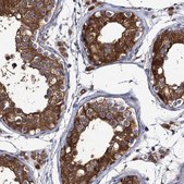 Anti-DYDC1 antibody produced in rabbit Prestige Antibodies® Powered by Atlas Antibodies, affinity isolated antibody, buffered aqueous glycerol solution