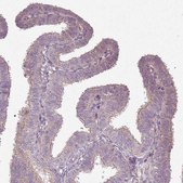 Anti-SLC16A9 antibody produced in rabbit Prestige Antibodies® Powered by Atlas Antibodies, affinity isolated antibody, buffered aqueous glycerol solution