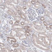 Anti-OPA1 antibody produced in rabbit Prestige Antibodies® Powered by Atlas Antibodies, affinity isolated antibody, buffered aqueous glycerol solution